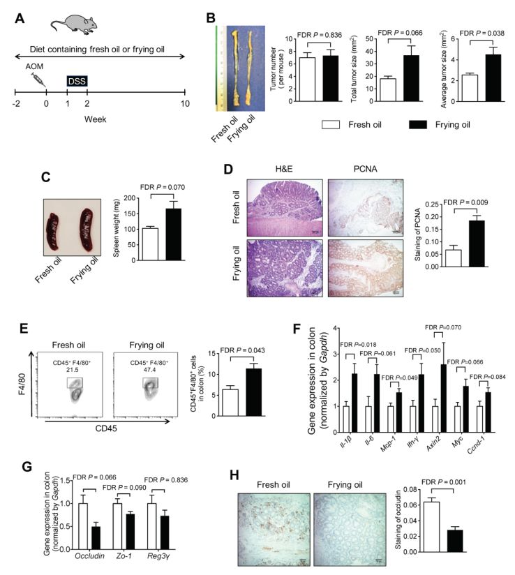 饮食油腻容易得胰腺肿瘤,饮食因素对肠癌的影响