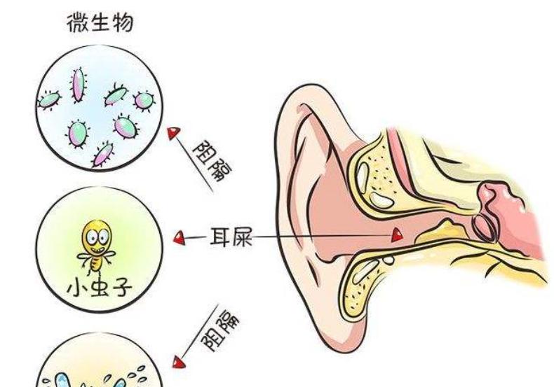 通过耳屎判断健康,关于耳屎你必须知道的几件事