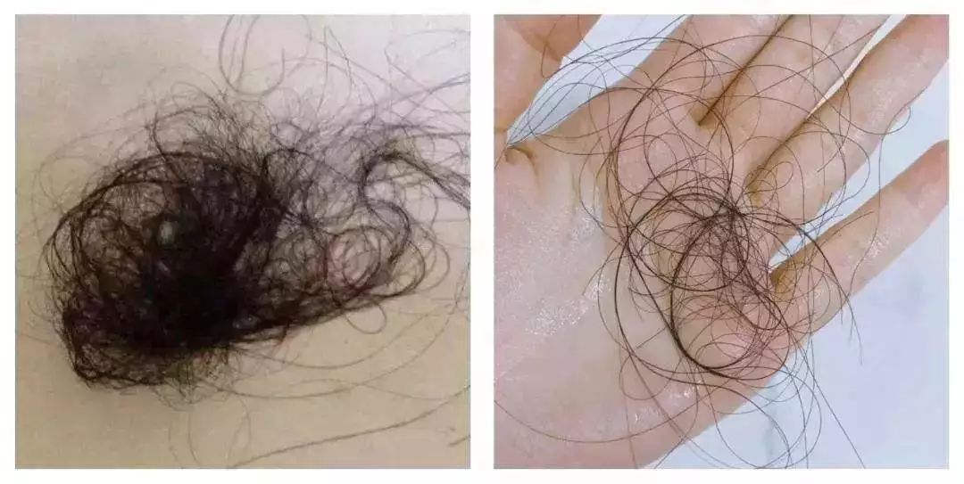 用它泡脚能赶走5种病,一个泡脚小药方赶走多种病