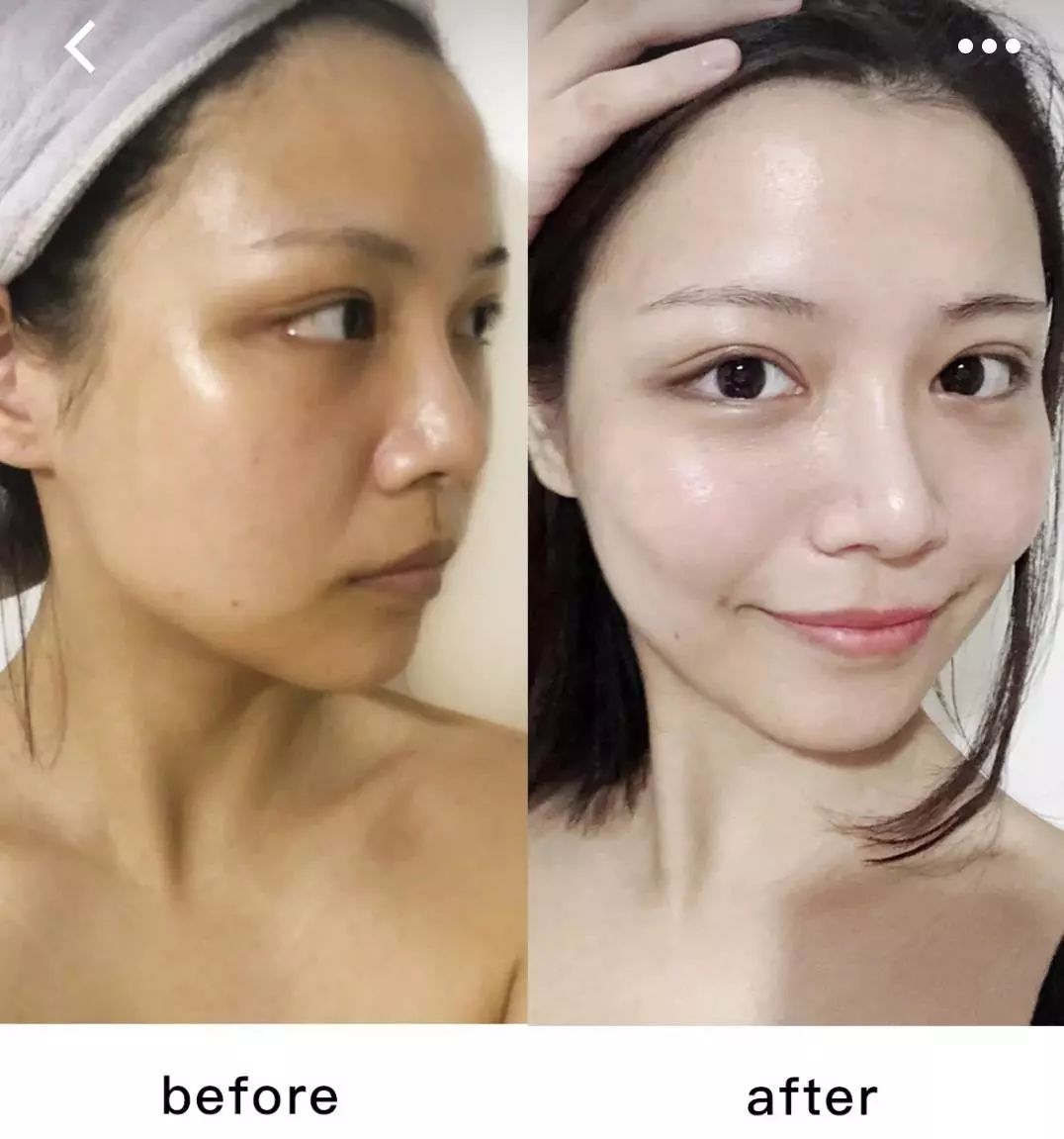 美白精华让你整个夏天都白得发光,美白精华猛料推荐