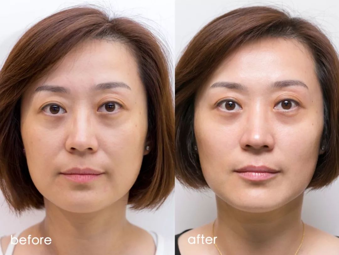 小茂肌诊室∣记一次网红咖啡店里的特别出诊