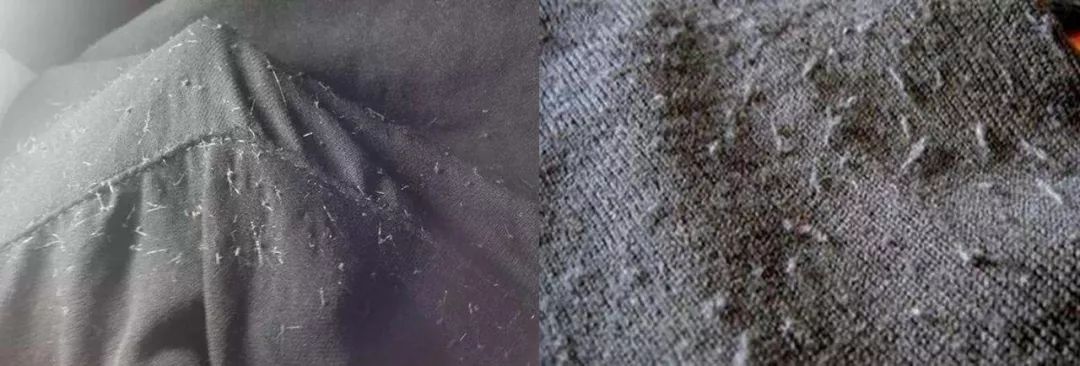 腿细翘臀神器,腿变得又细又直神器