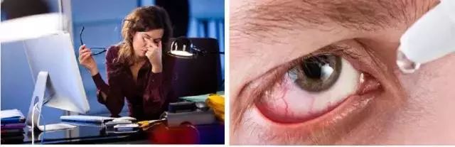 适合熬夜的护眼神器,眼睛疲劳用什么护眼神器