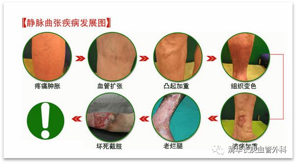 认识静电现象教案,认识静电教案