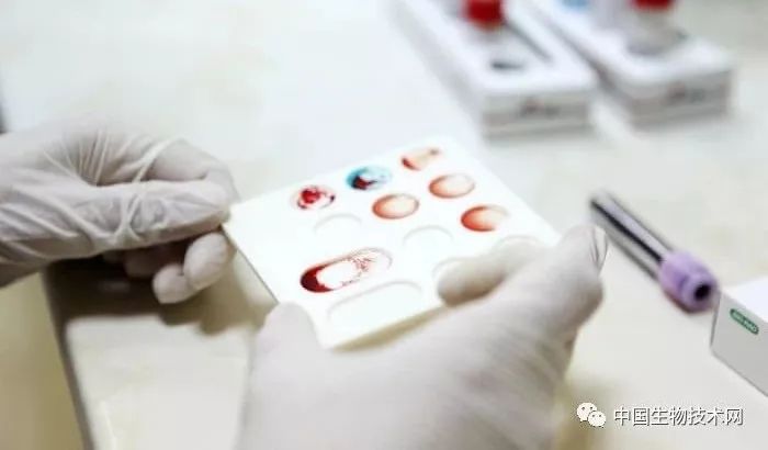 免疫治疗能抑制肿瘤生长吗,目前常用的肿瘤免疫治疗手段