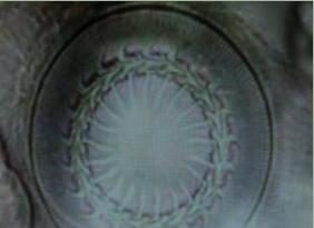 罗汉鱼白点病最有效的方法,鱼病车轮虫