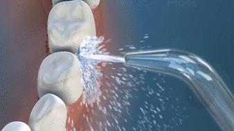 9成中国人没见过，洗牙就用1分钟，美国人用了很久的洁牙神器