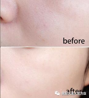 超便宜补水保湿精华,超好用的补水精华