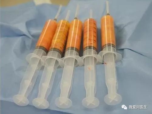 脂肪最怕的食物让你越吃越瘦,脂肪最怕的肉物你知道吗