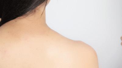 无痛拯救12亿低头族！5分钟搞好酸、痛、僵、麻，解颈椎“夺命包”