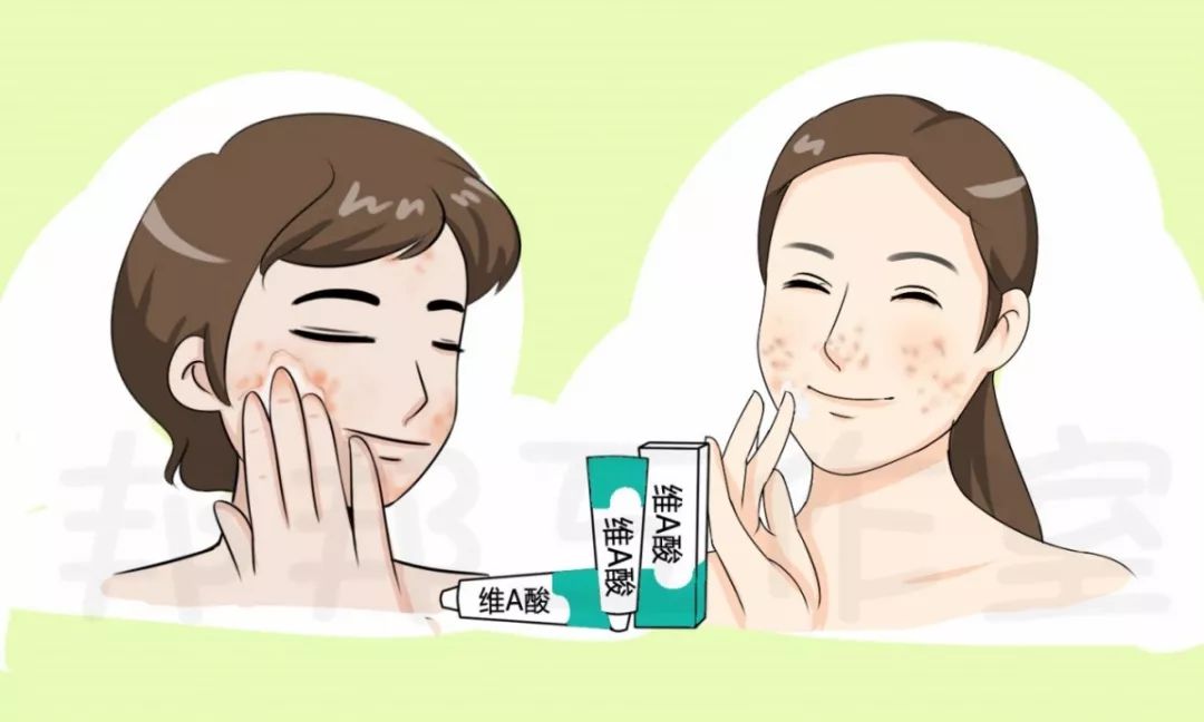 为什么维a酸能治痘,治疗痘痘的维a酸乳膏你用对了吗