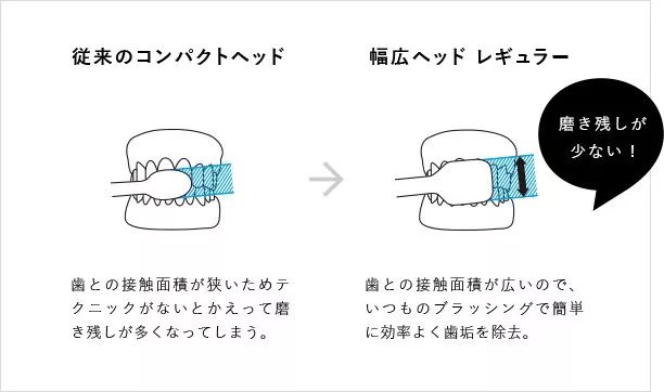 适合刷大牙的牙刷,好用不伤牙齿的电动牙刷推荐
