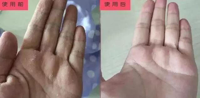 神奇绵羊油,润肤用的绵羊油