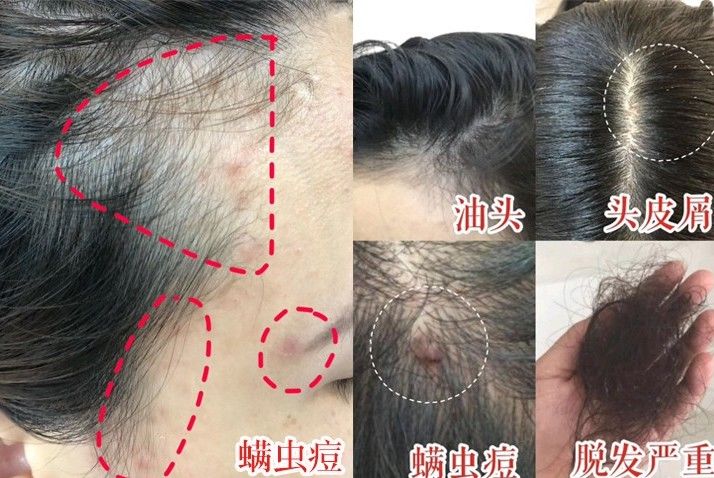 床上放个它，让螨虫绝望，让螨虫自杀，比太阳暴晒强1万倍