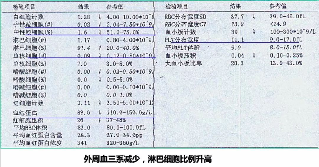 再生障碍性贫血能治好吗,再生障碍性贫血知识拓展