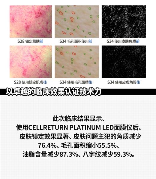 led面膜仪有效果吗,led面膜仪十大品牌