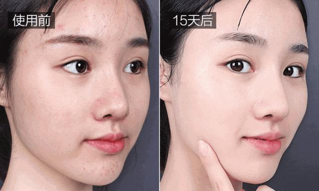 喝胶原蛋白要坚持多久才能有效果,紧急提醒经常喝这个的人要注意了