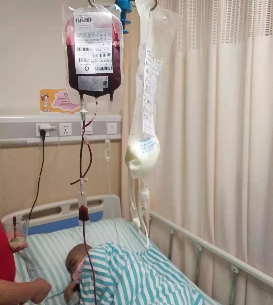 再生障碍性贫血移植后能彻底治愈,小孩再生障碍性贫血骨髓移植后