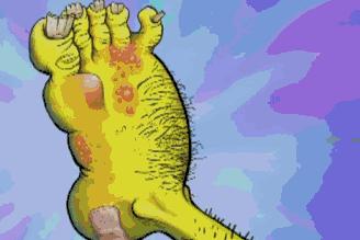 什么袜子专治脚臭,什么袜子治臭脚