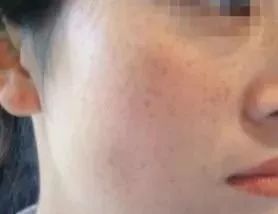 你皂吗?ta凭借淡斑美白效果,被外国姑娘囤疯了