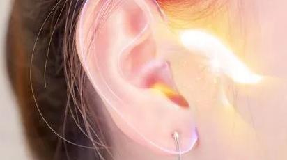 为什么有糠耳,糠耳与油耳的区别