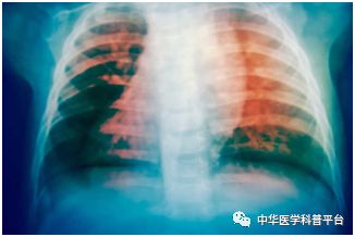 盗汗的可能原因,男人盗汗的原因