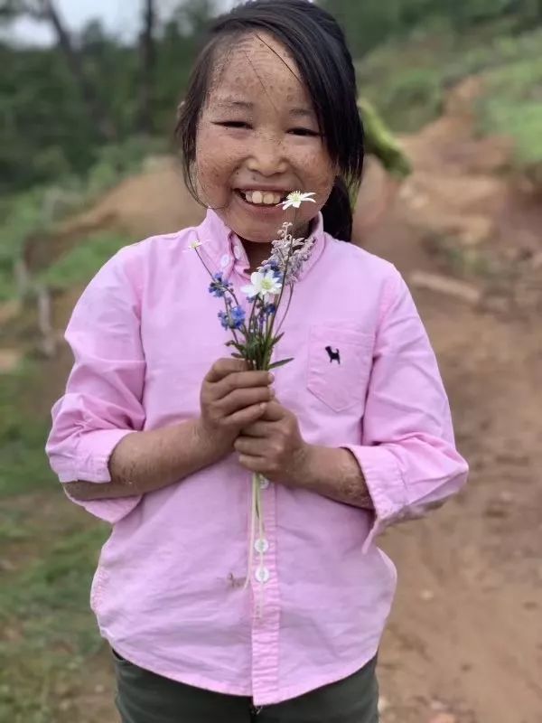 扶贫帮困情永在——期待“鱼鳞女孩”的蜕变重生