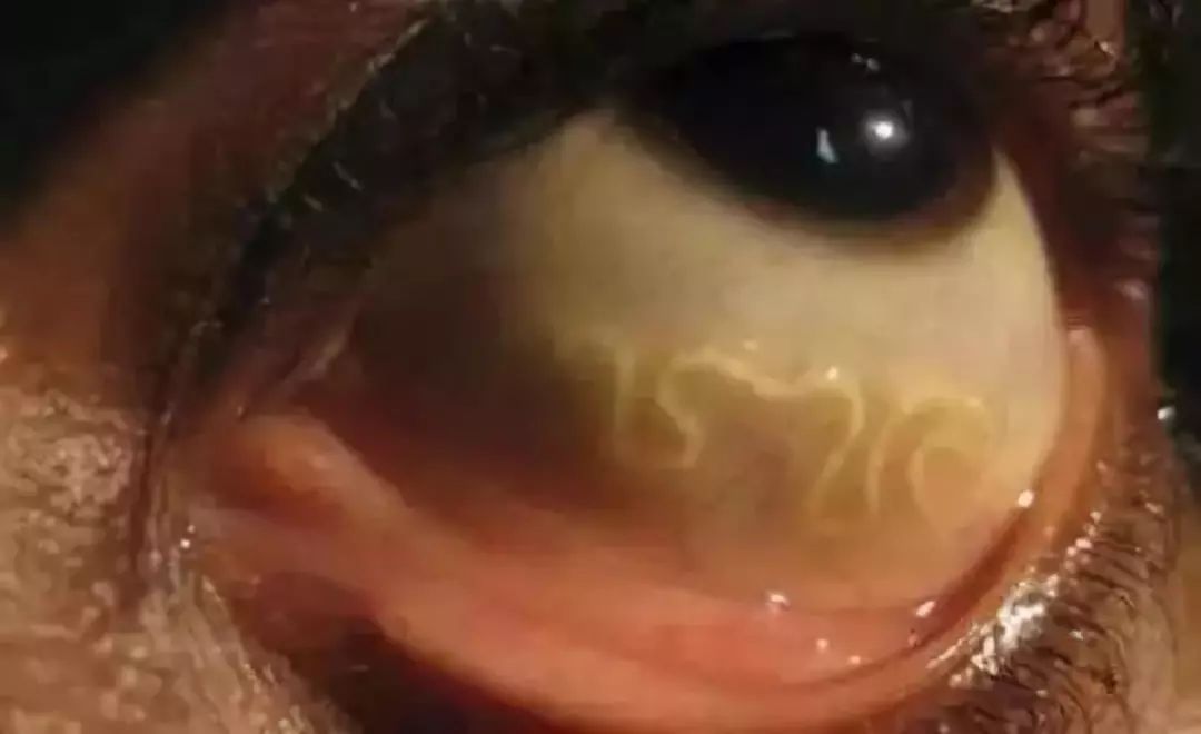 眼睛长虫子的前兆,有眼睛的恐怖的虫子