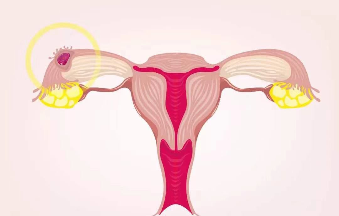 不孕不育占正常人比例,不孕不育一半以上原因在男性