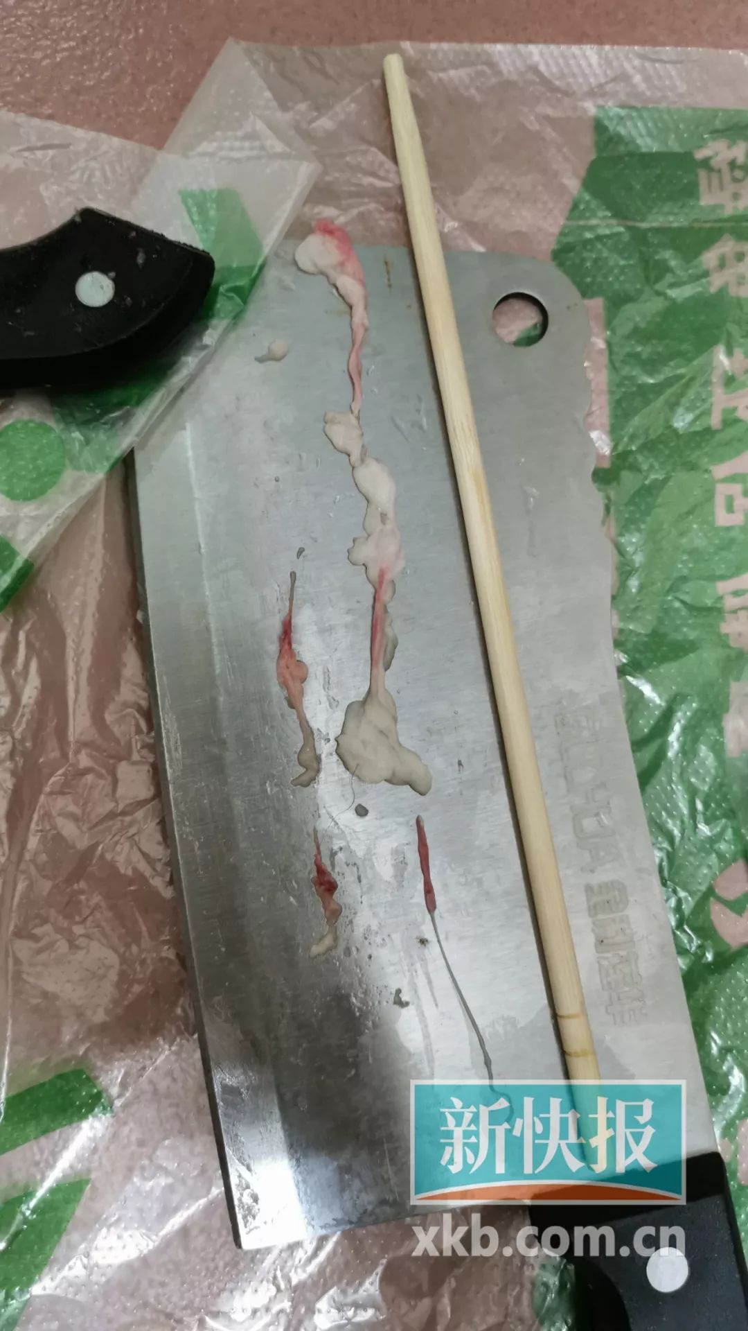 猪肉吃出白色寄生虫,猪肉里有活的白色寄生虫