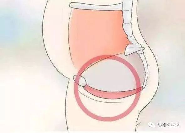 关于盆底康复你想知道的都在这里,老年女性盆底有病什么症状