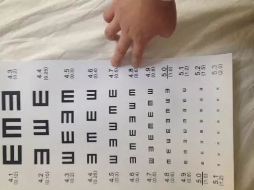 近视预防从幼儿抓起,近视孩子防控成功