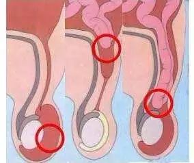 勿以病小而不医勿以病大而自弃,勿以小而不为