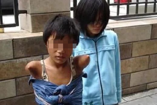 眼球被挖的人后续,眼球被挖了一个洞还能恢复吗