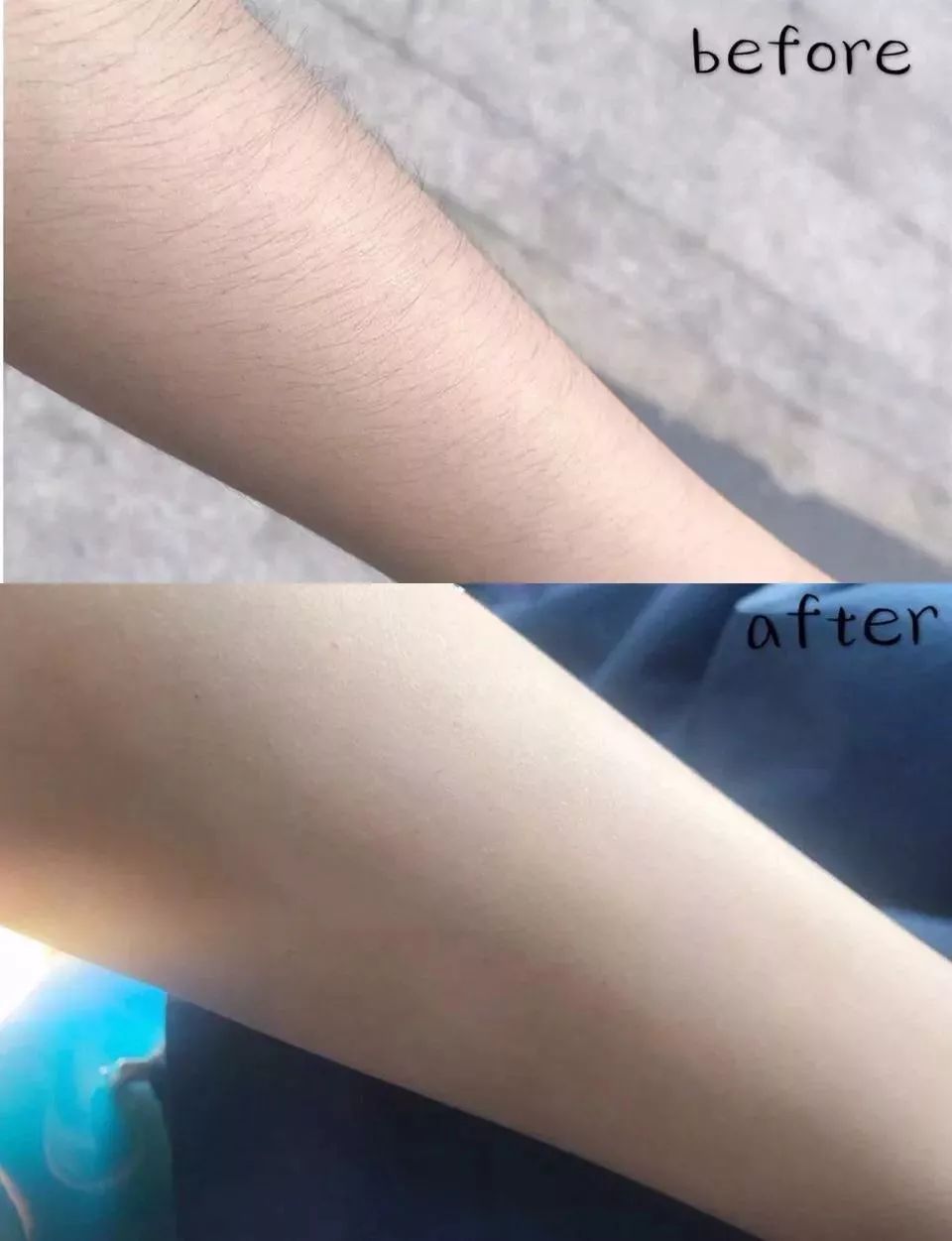 脱毛是不是秋冬季最适合,夏季脱毛便宜的方法有哪些