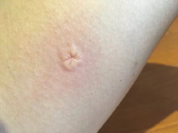 早上6点多公交车挤不挤,早上的公交车非常拥堵