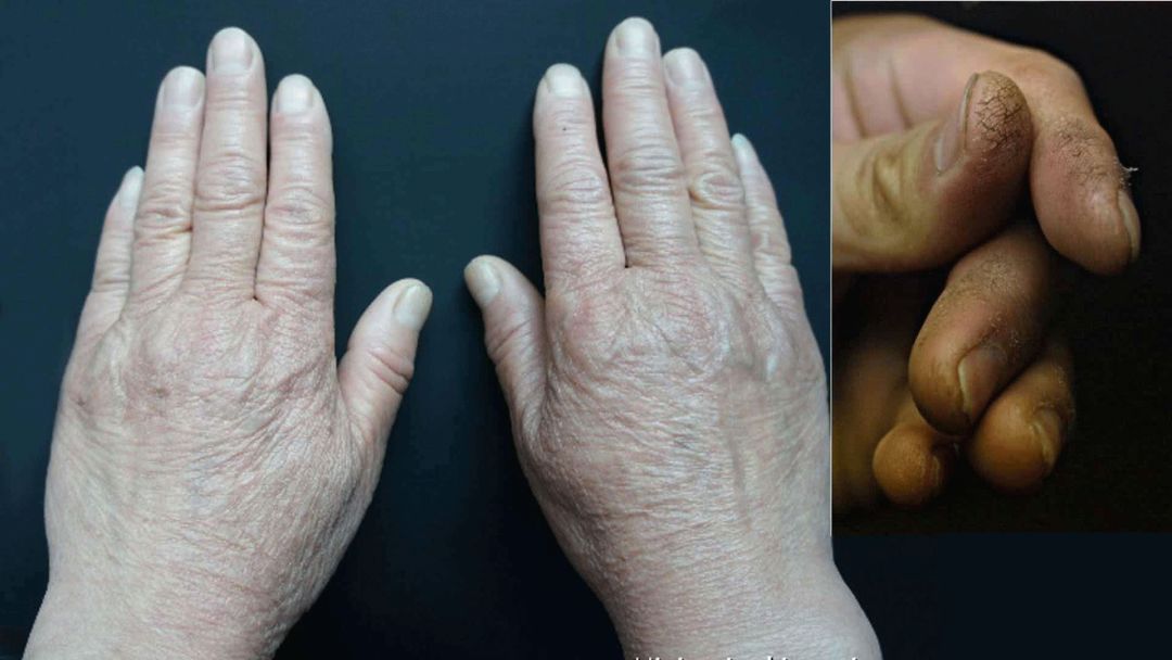 厨房必备神器家里油烟机难清洗,清洗油烟机必备神器