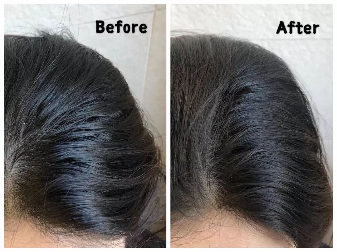 早晨起床对抗懒癌,懒癌晚期护肤的正确方法