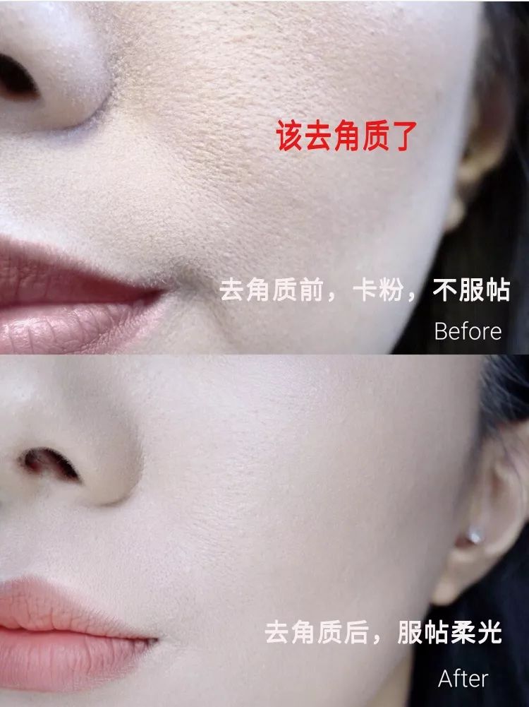 脸上搓出3斤泥！难怪又黄又暗又黑头！10秒给脸蛋“剥壳”，厉害