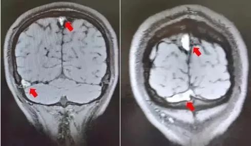26岁小伙熬夜头晕,28岁小伙熬夜加班49小时