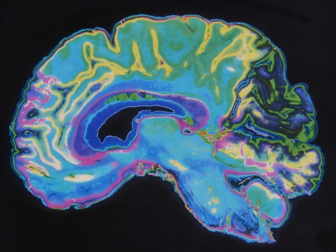 为什么咖啡因会控制体重？科学家离研制成功预防痴呆疫苗又近一步，一种新的自体免疫疾病被发现