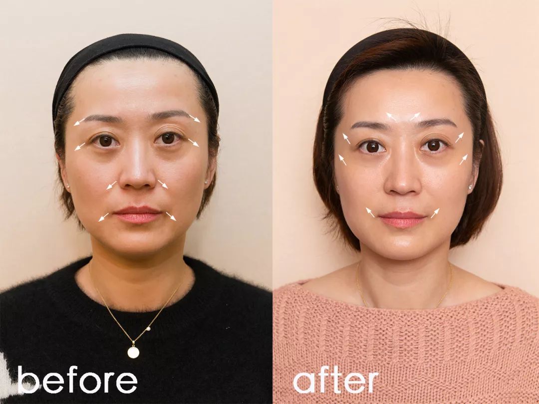 地表最强修复肌肤屏障,地表最强肌诊室