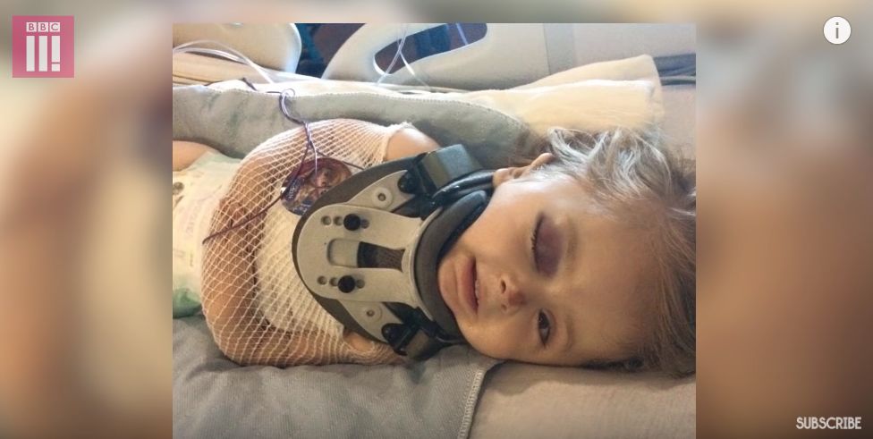 细微的骨折是一种怎样的疼痛感,骨折的疼痛有一群人要体会几十次