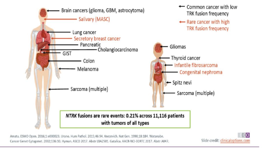 最好的罕见肿瘤药,肿瘤及罕见病目录
