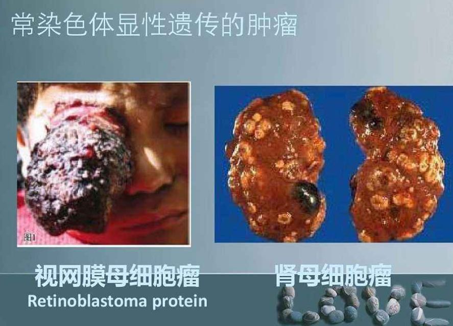 最新治疗恶性肿瘤药,12种抗肿瘤新药目录