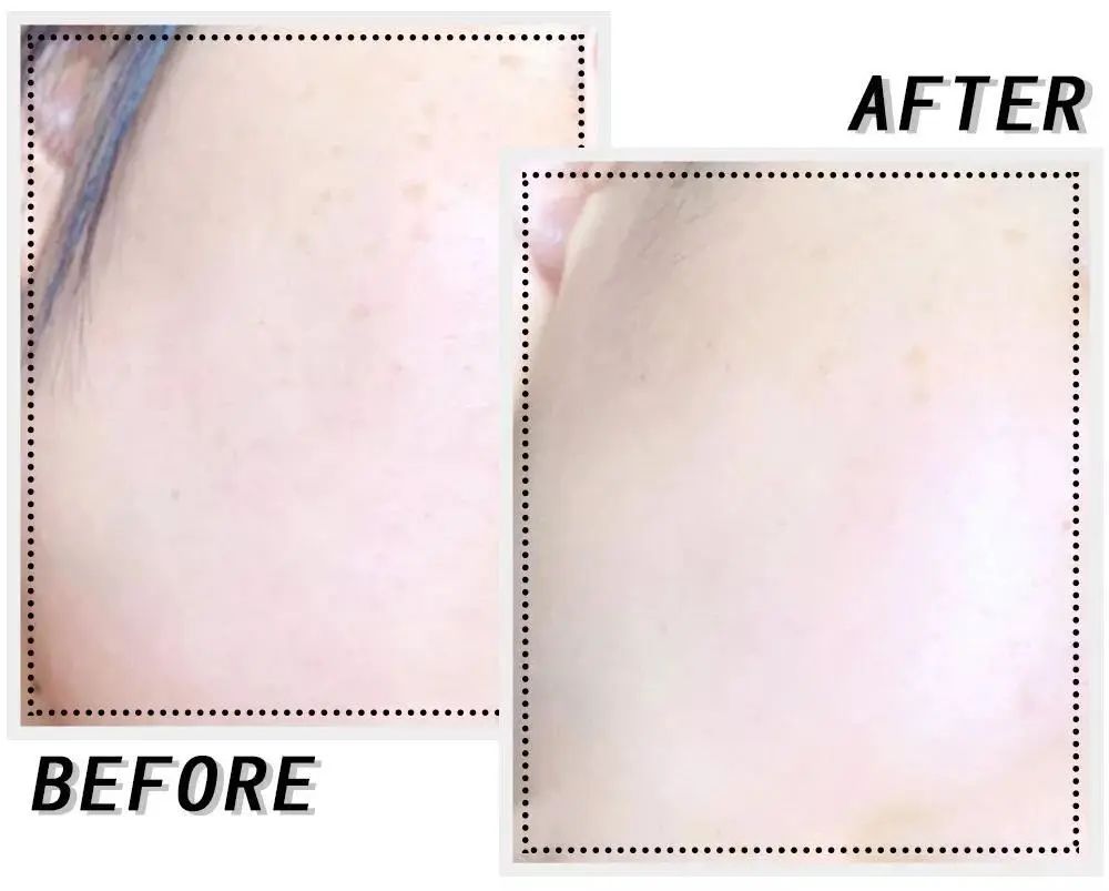 女明星逆龄回春的秘密,女明星冻龄真相