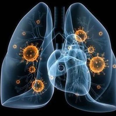 防治新冠肺炎中成药专家推荐,新型冠状病毒专家解读