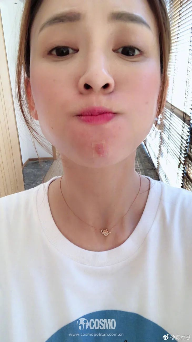 美人计|听说戴口罩之后就疯狂冒痘，我来给你诊断诊断
