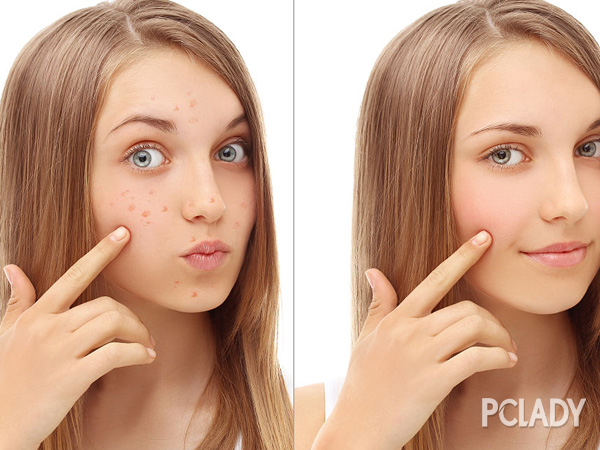 脸部肤色不均匀抹什么,脸部肤色不均匀怎么办医美