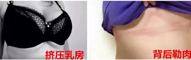 99%的女生都可能得的妇科疾病,99%的女生所不知道的小秘密